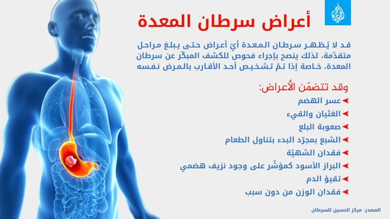 ورم في المعدة